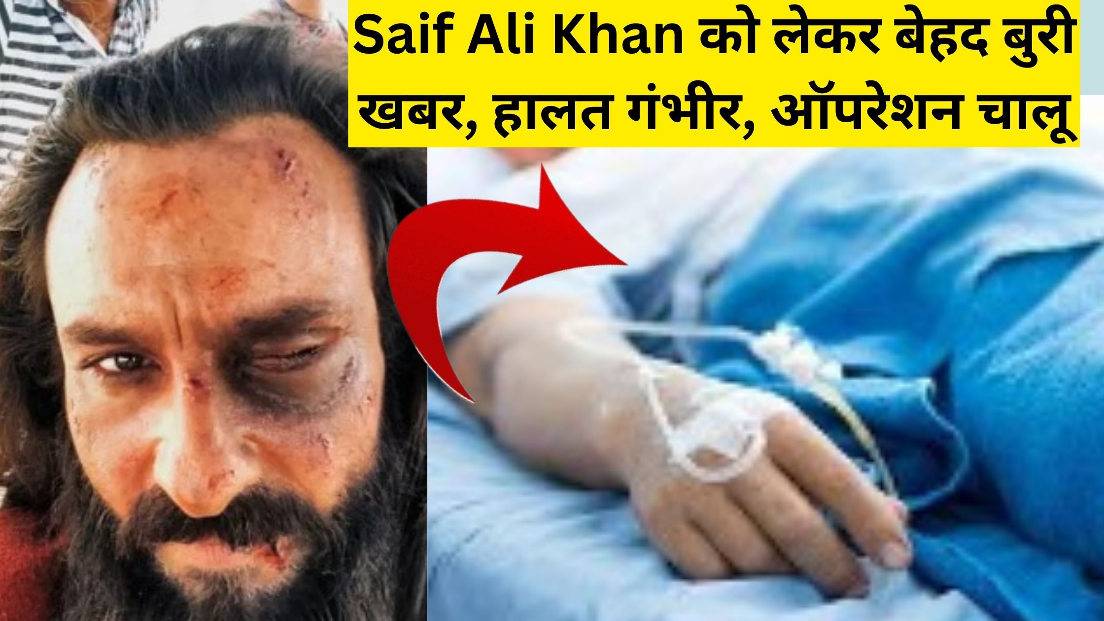 Very bad news came out about Saif Ali Khan: condition critical, just admitted to hospital, operation underway.